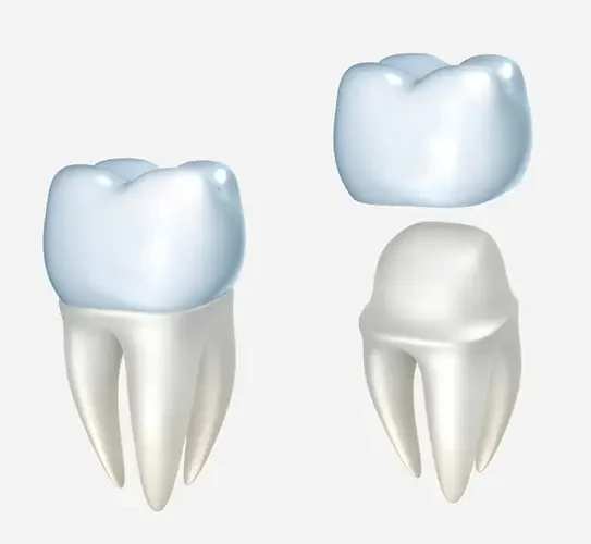 Crown Lengthening