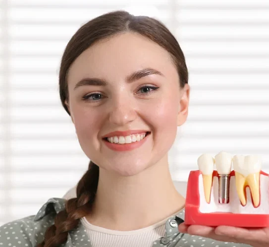 Dental Implants
