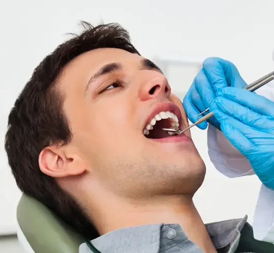 Gingivectomy