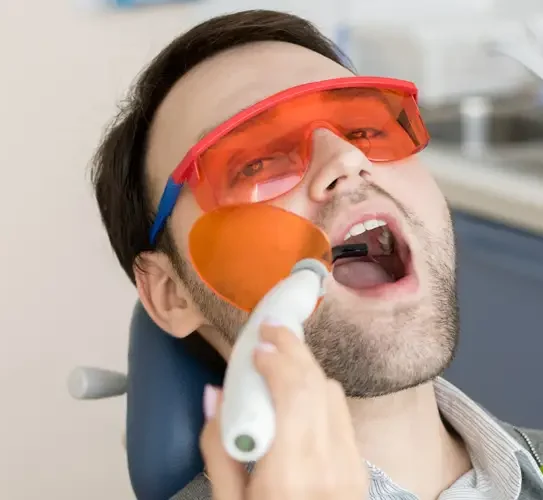 Laser Treatment of Cold Sores